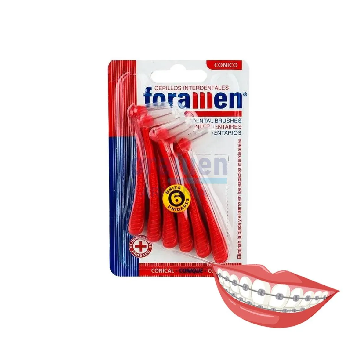 Foramen_Interdental_curve1_3_1_5